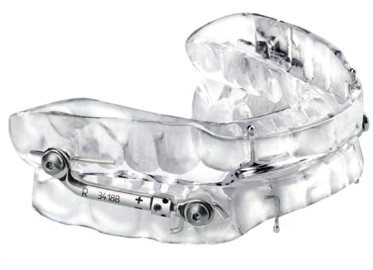 oral appliance for snoring